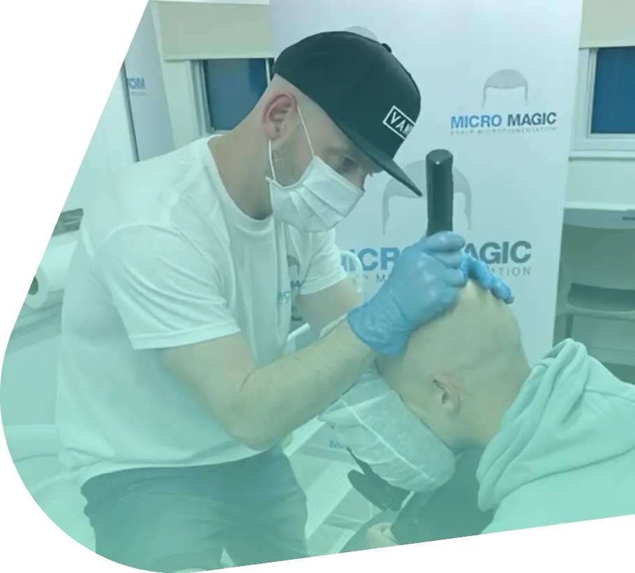 Stuart Buckley carrying out a scalp micropigmentation treatment