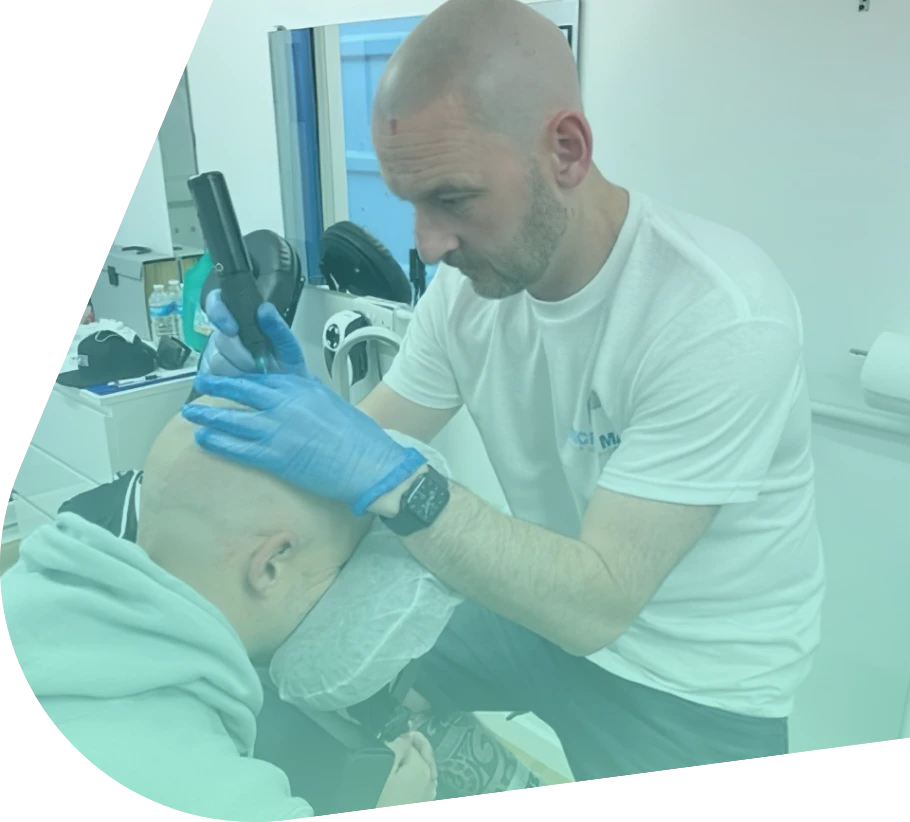 Stuart Buckley carrying out a scalp micropigmentation treatment