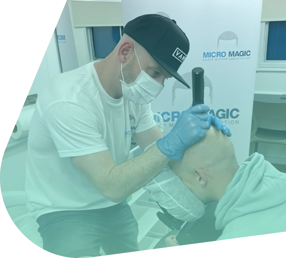 Stuart Buckley carrying out a scalp micropigmentation treatment
